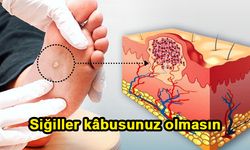 Siğiller kâbusunuz olmasın