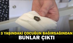 3 yaşındaki çocuğun bağırsağından 7 tane mıknatıs çıktı
