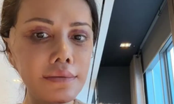 Eski Survivor Yarışmacısı Didem Ceran Yüz Nakli Yaptırdı! Operasyon İki Gün Sürdü