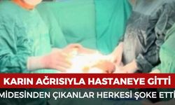 Karın ağrısıyla hastaneye gitti: Midesinden çıkanlar şoke etti