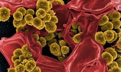 Sadece Saatler İçinde Yayılıyor! Et Yiyen Bakteri Hakkında Bilmeniz Gereken Her Şey: İşte Kurtuluş Reçetesi!