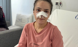Eşinin Isırarak Kopardığı Burnu Başarılı Ameliyatla Yerine Dikildi! Genç Kadın Yaşadığı Dehşeti Anlattı
