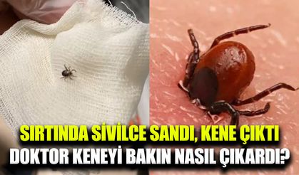 Sivilce sandığı kene paniği hastanede son buldu