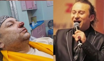 Durumu Kritik! Onur Akay Entübe Edildi: "Et Yiyen Bakteri" Vücudunu Esir Aldı!