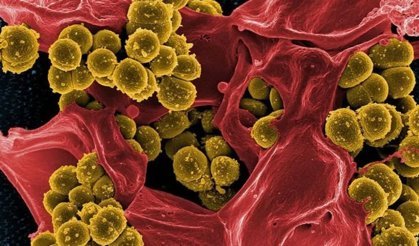 Sadece Saatler İçinde Yayılıyor! Et Yiyen Bakteri Hakkında Bilmeniz Gereken Her Şey: İşte Kurtuluş Reçetesi!