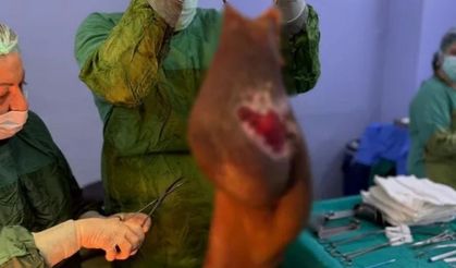 67 yaşındaki kadının midesinden çıkan şoke etti! Tam 40 kilogramlık kitle çıkarıldı