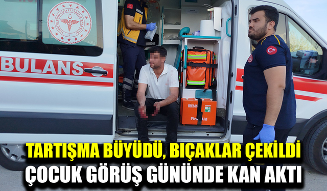 Eski eşler arasında çocuk görüş gününde kanlı kavga