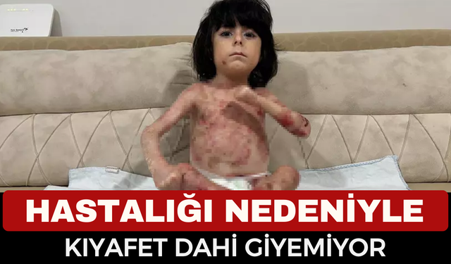 4 Yaşındaki İbrahim Kıyafet Bile Giyemiyor! Aile Yardım Bekliyor