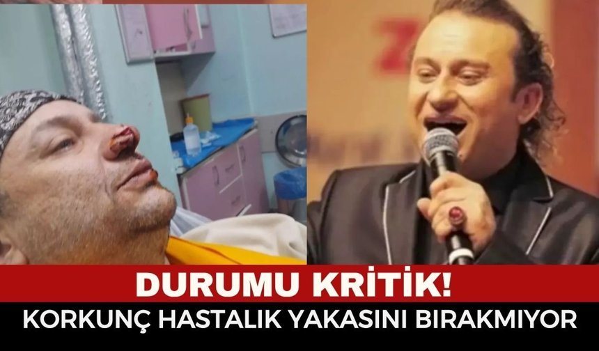 Durumu Kritik! Onur Akay Entübe Edildi: "Et Yiyen Bakteri" Vücudunu Esir Aldı!