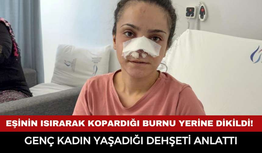 Eşinin Isırarak Kopardığı Burnu Başarılı Ameliyatla Yerine Dikildi! Genç Kadın Yaşadığı Dehşeti Anlattı